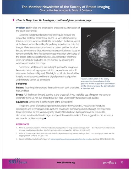 How to Help Your Technologist: Part 3 – Mammography Educators