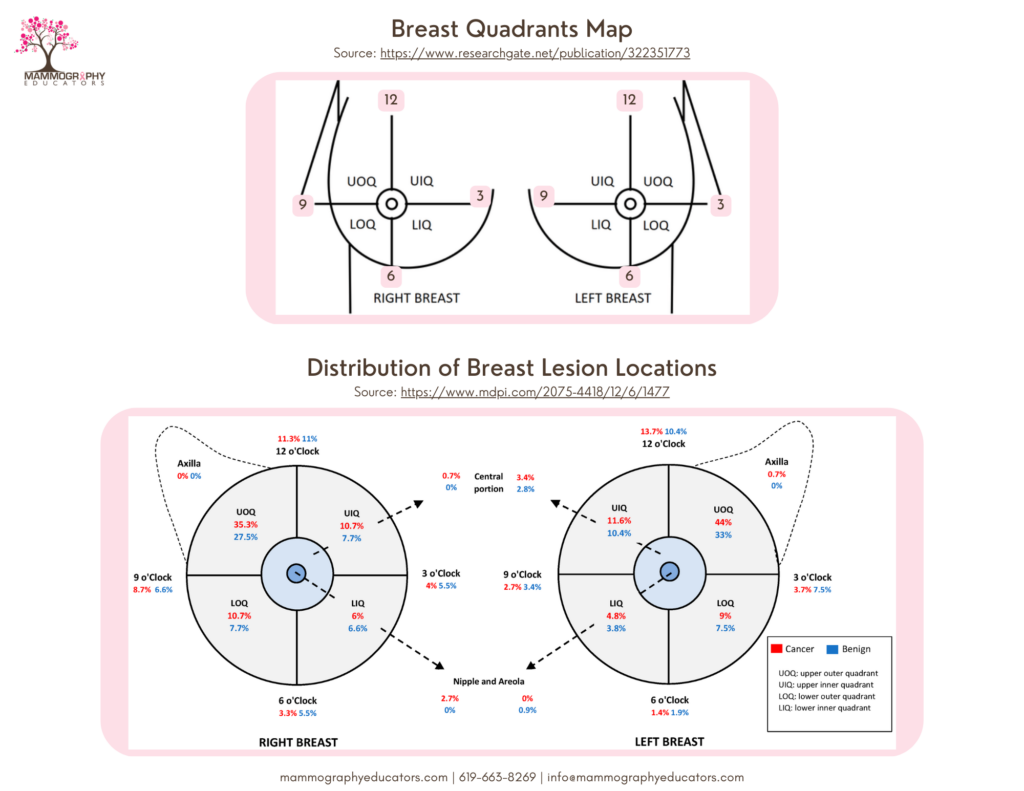 Quadrants And Cancer Distribution On The Breast 1024x791 