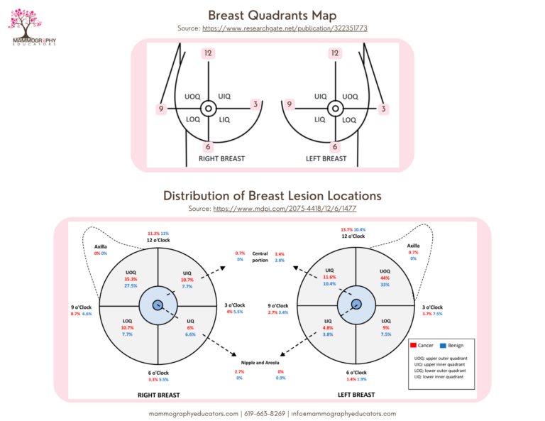 Quadrants And Cancer Distribution On The Breast 768x593 