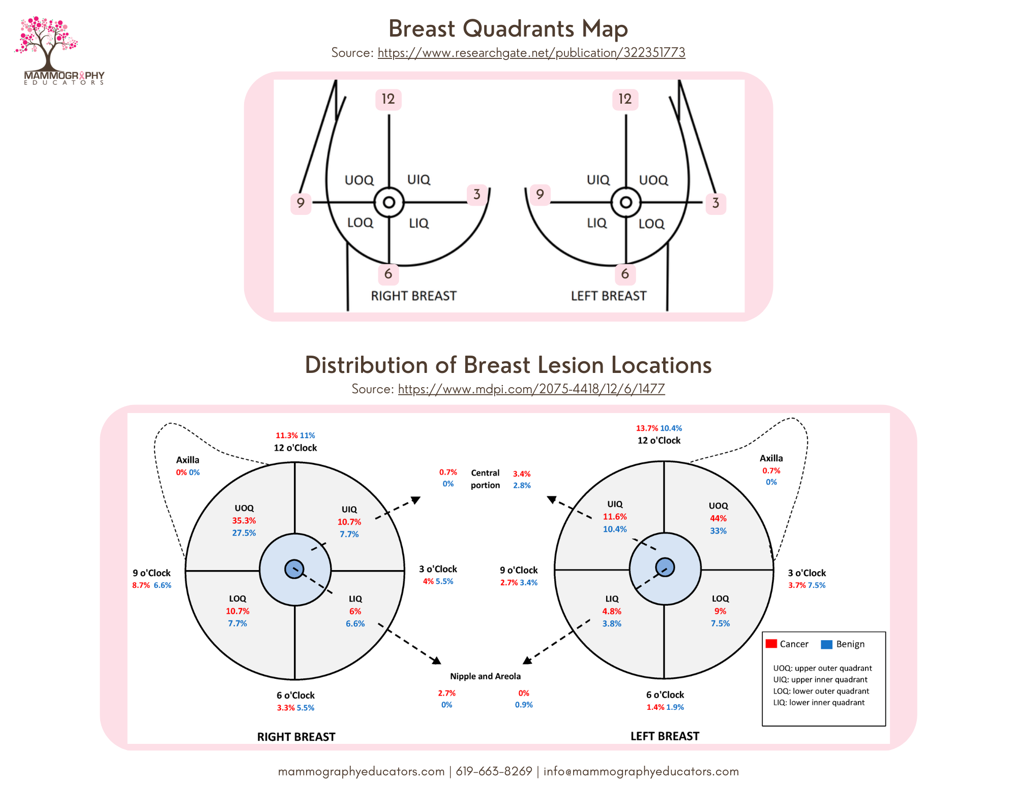 Breast Quadrant Map and Distribution of Breast Lesion Locations